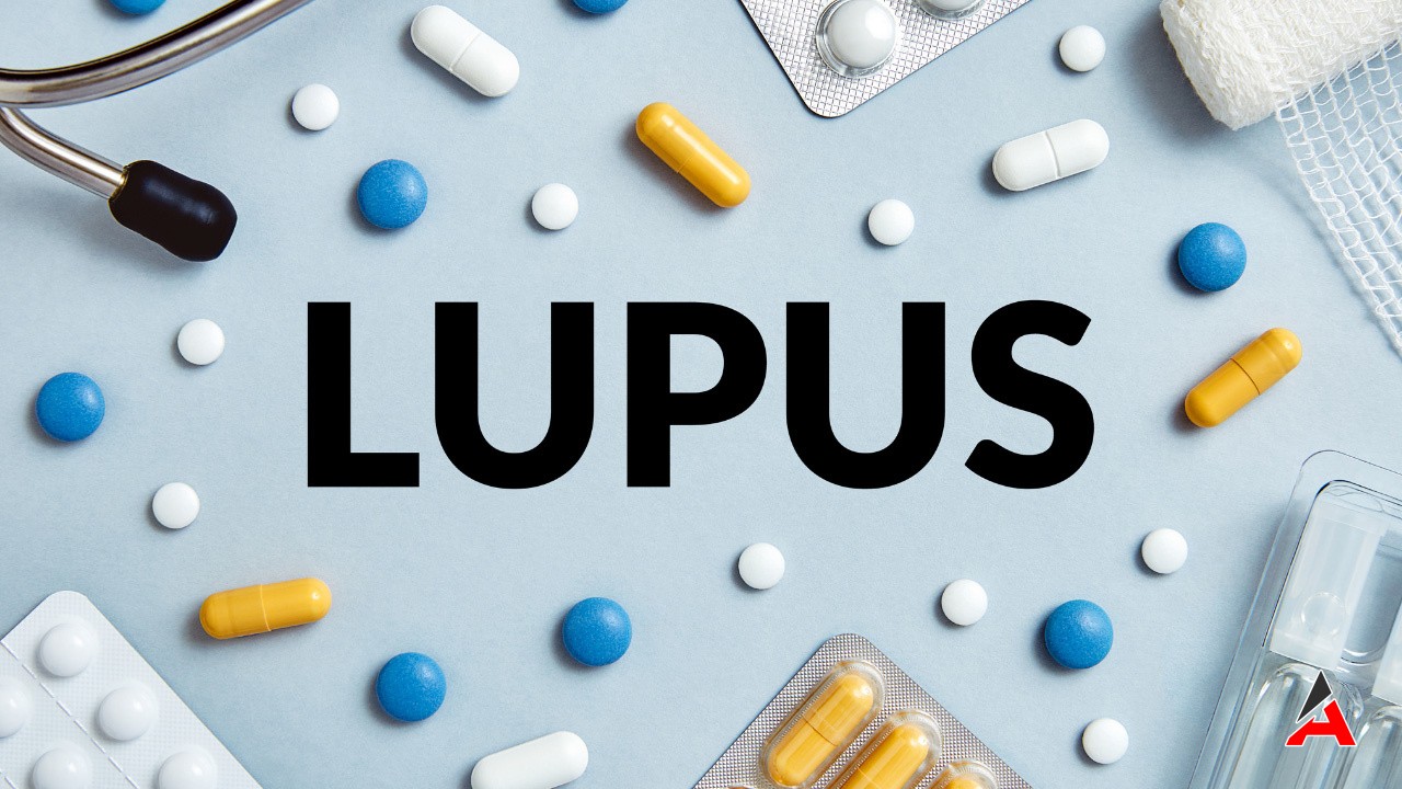 Lupus